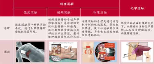 南微醫(yī)學 688029 微創(chuàng)診療器械龍頭